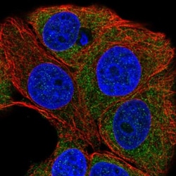 PKC eta Antibody, Novus Biologicals 0.1mL; Unlabeled:Antibodies, Polyclonal